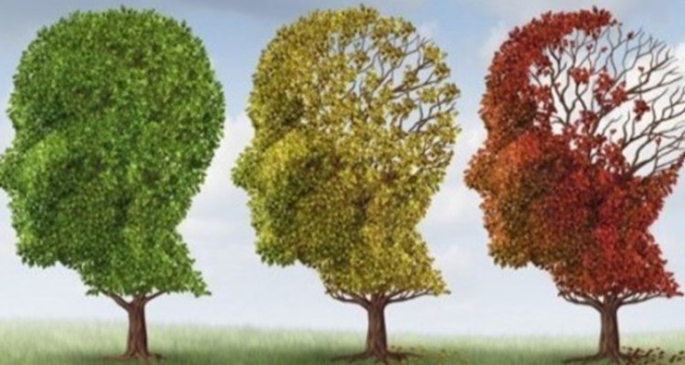 خواندنی‌ها درباره آلزایمر