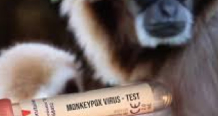 نگرانی مردم بی مورد است/ مورد مشکوک به آبله میمون در ایلام مشاهده نشده