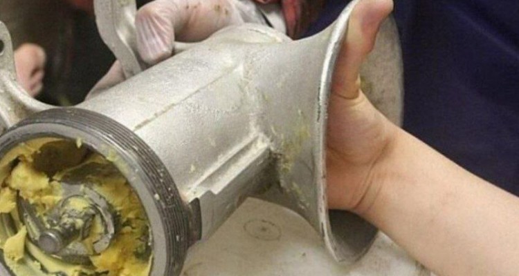 چرخ گوشت انگشتان کودک ایلامی را بلعید