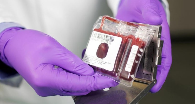 ذخیره 1500 نمونه خون بندناف در بانک سلول بنیادی ایلام