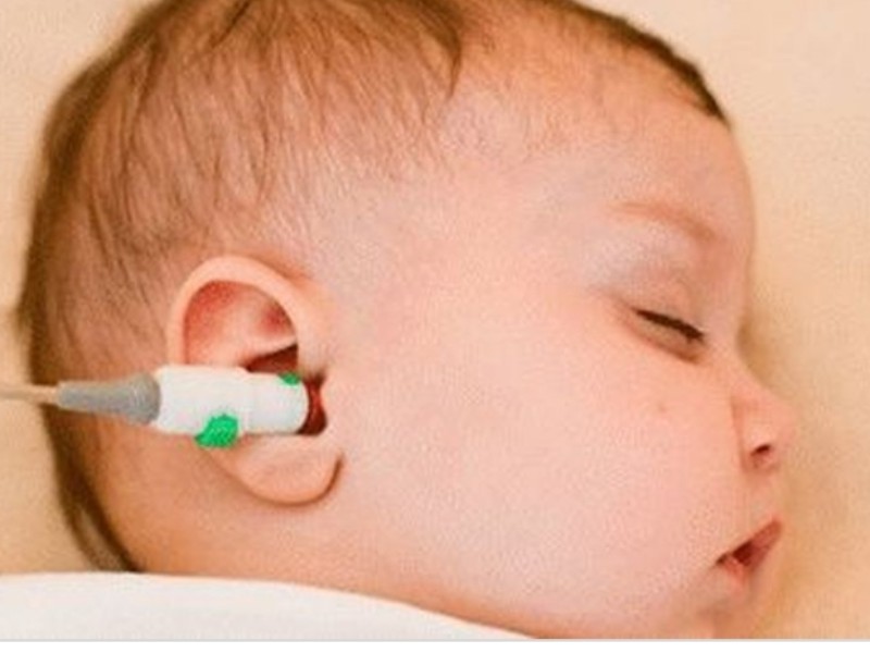 غربالگری شنوایی بیش از ۷ هزار نوزاد در ایلام غربالگری شنوایی بیش از ۷ هزار نوزاد در ایلام